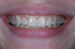 Upstate smiles dental service