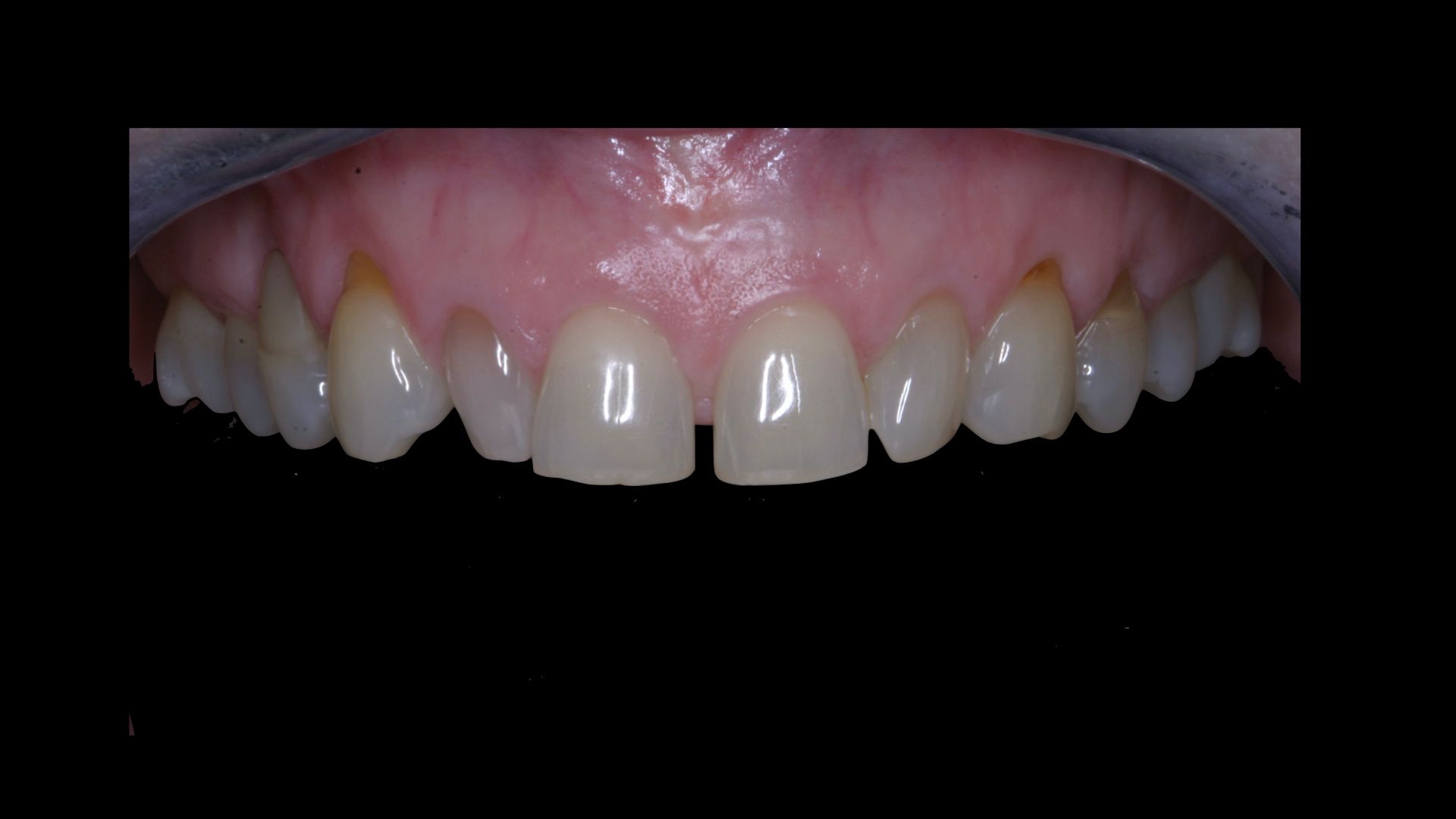 Upstate smiles dental service