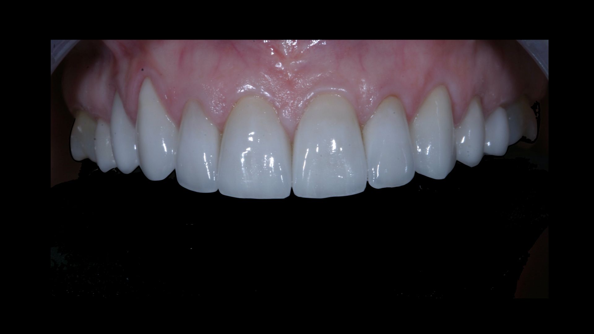 Upstate smiles dental service