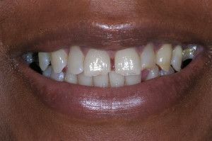 Upstate smiles dental service