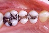 upstate smiles dental service