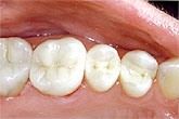 upstate smiles dental service