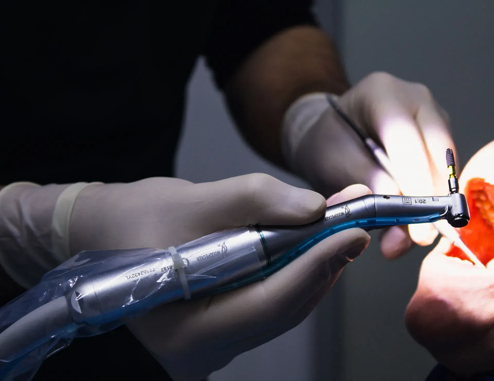 Gloved hands using a dental drill on a patient’s teeth under bright clinical light