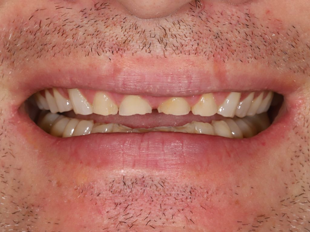 Upstate smiles dental service 