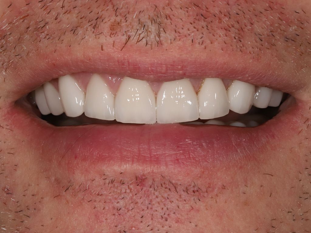 Upstate smiles dental service