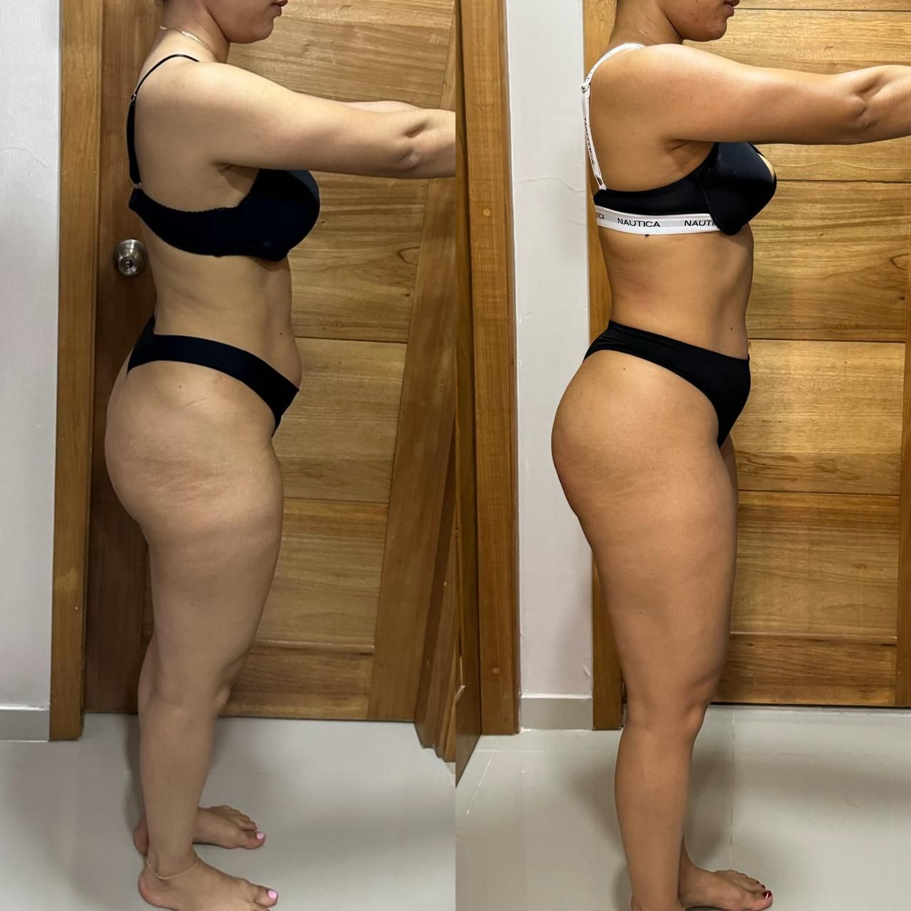 transformation