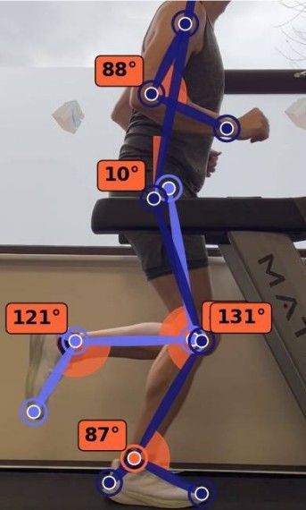 Gait Analysis | Kube Medical