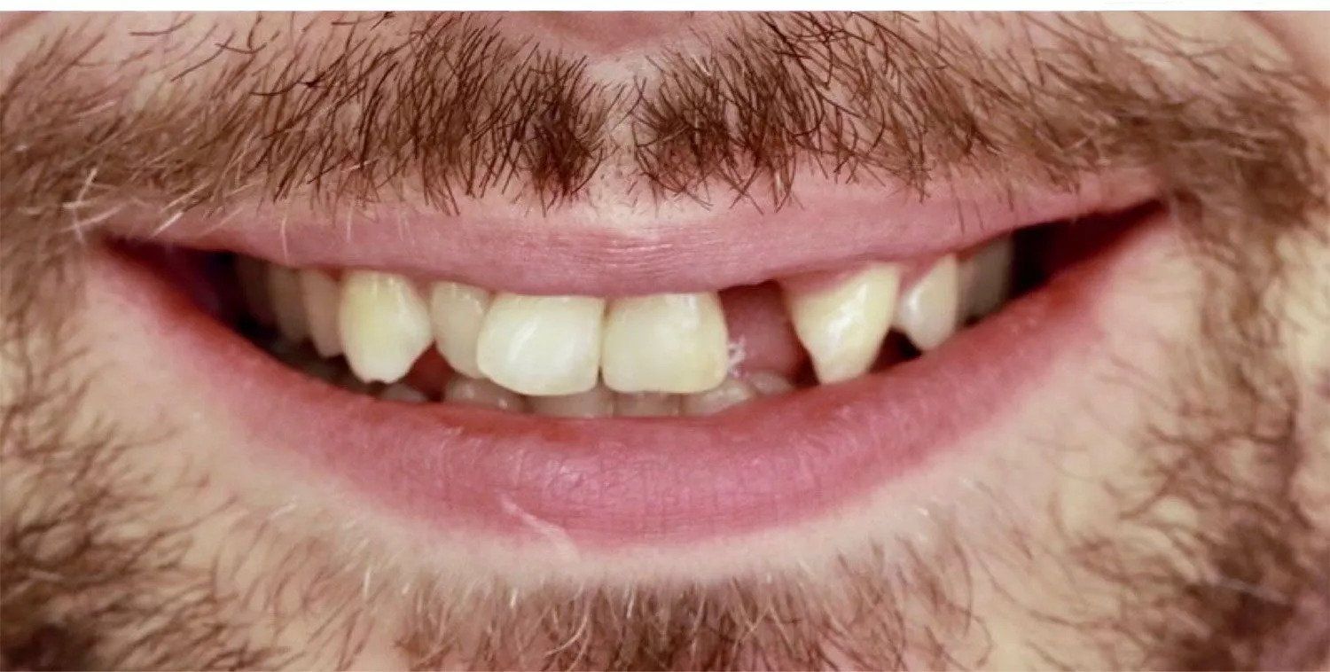 teeth before