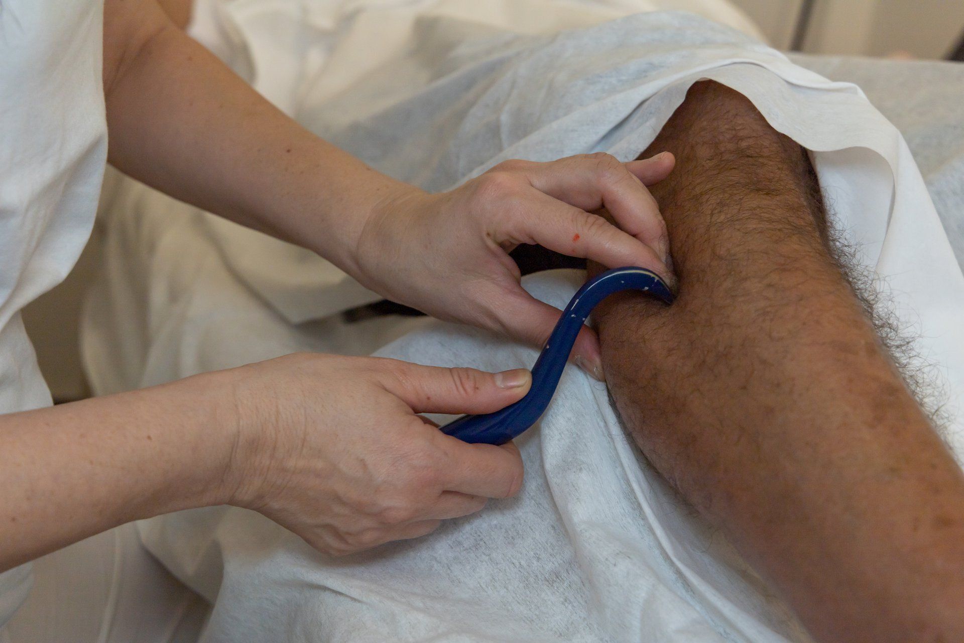 Persona sottoposta a terapia muscolare sul braccio con uno strumento blu a forma di uncino, su un lenzuolo bianco.
