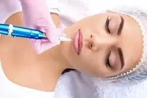 Cosmetic facial treatment on a woman lying down, with a gloved hand using a blue device on her cheek