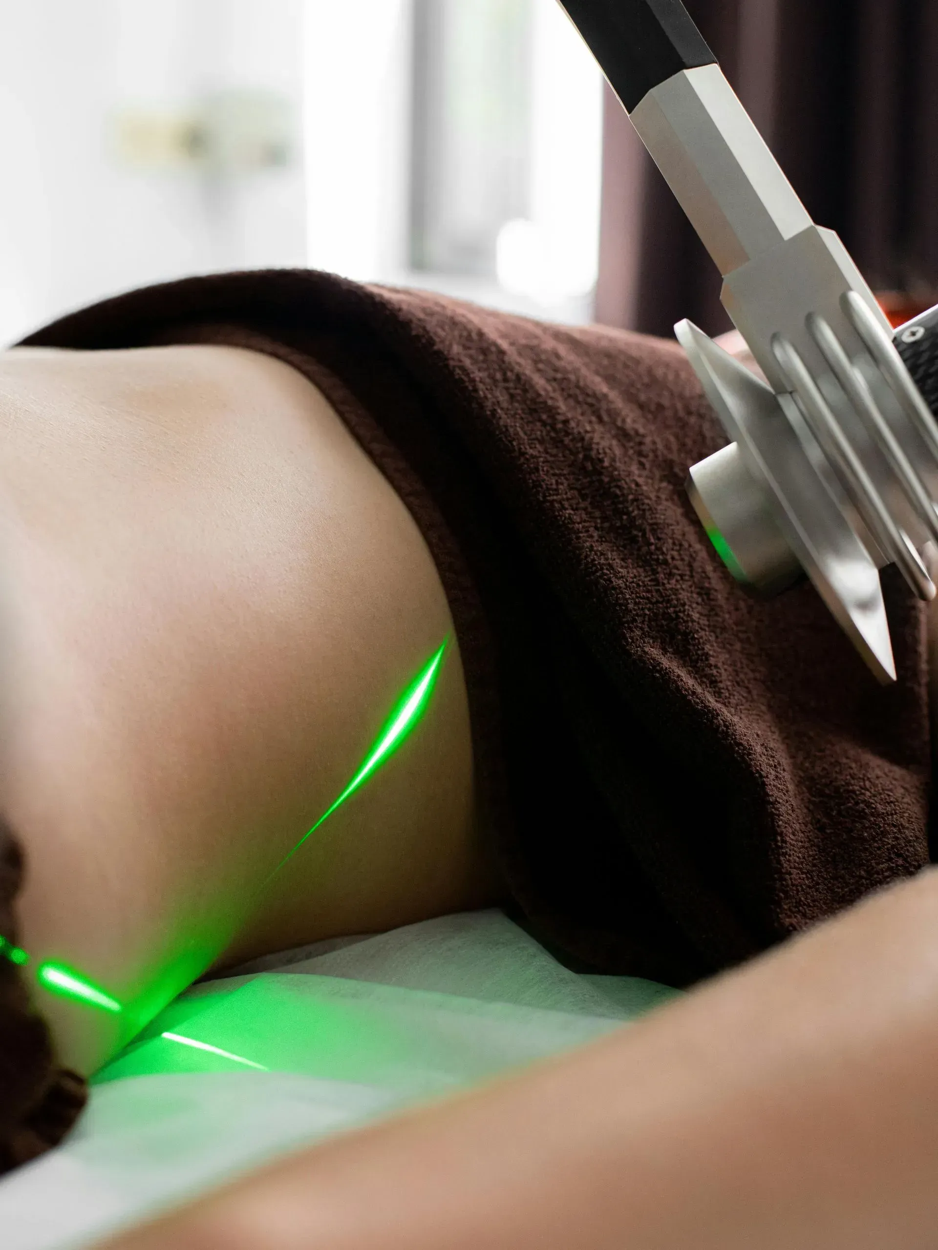 Laser treatment on a person’s back with green light on a spa table