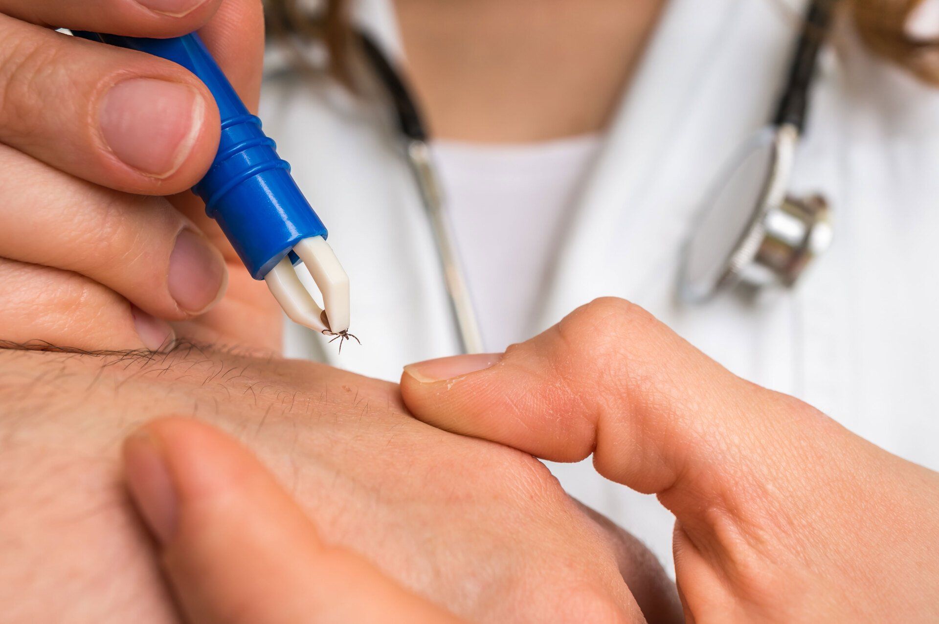 Lyme Disease Treatment in Lake Mary Florida