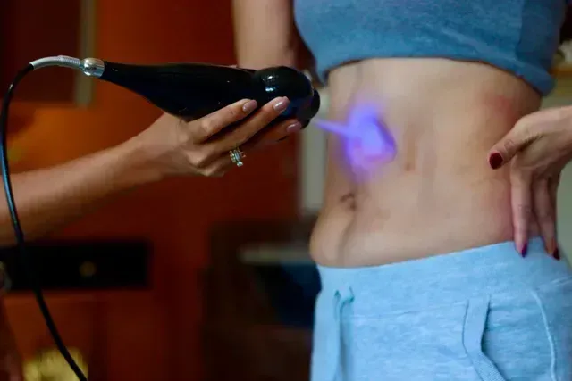 Person uses a blue-purple light device on another person’s bare lower back.