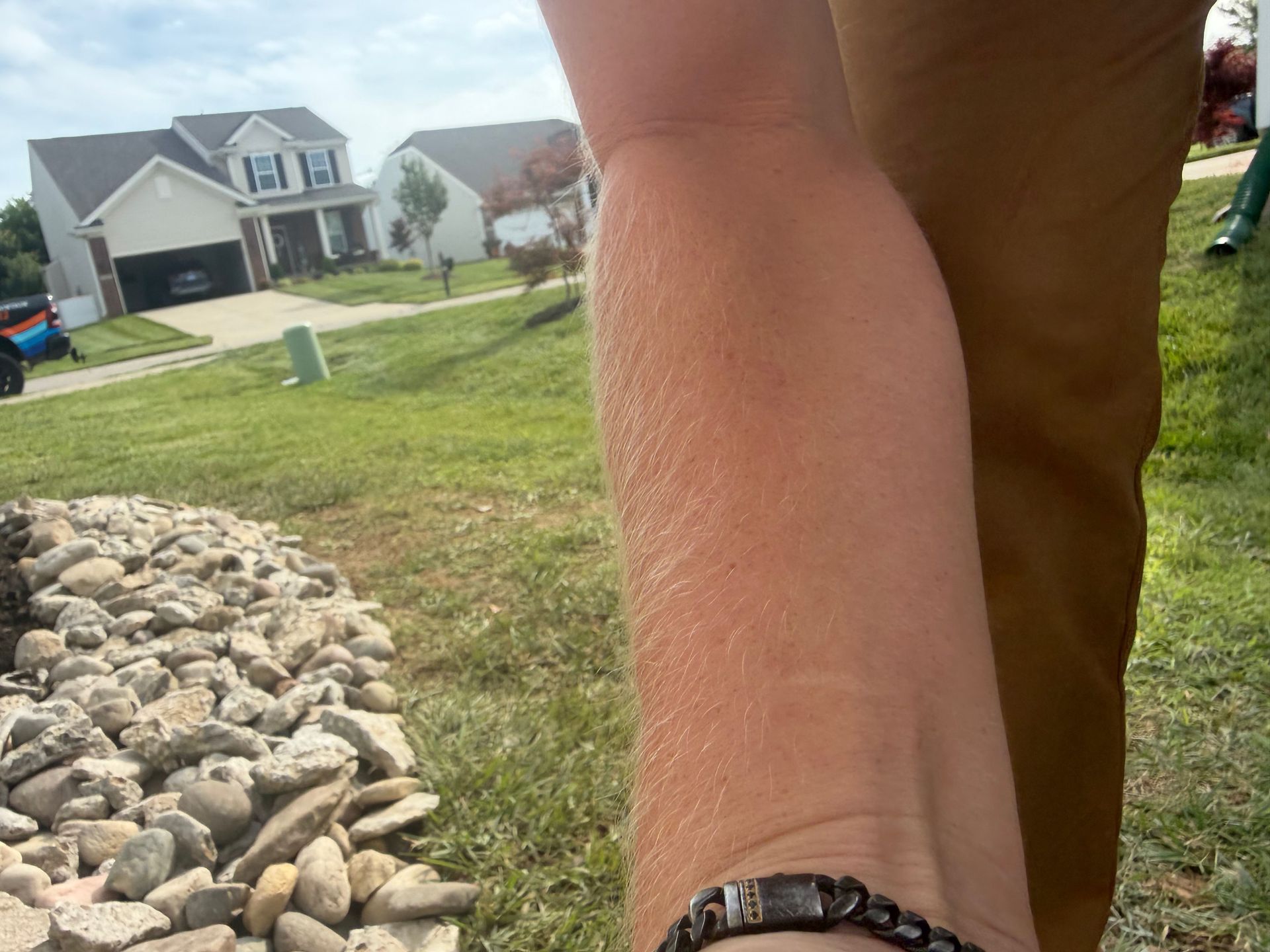 Person’s forearm with a bracelet in the foreground, overlooking a suburban lawn and houses.
