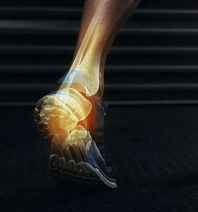 An X-ray overlay shows the bones of a foot and ankle inside a running shoe, with a glowing red highlight on the heel.
