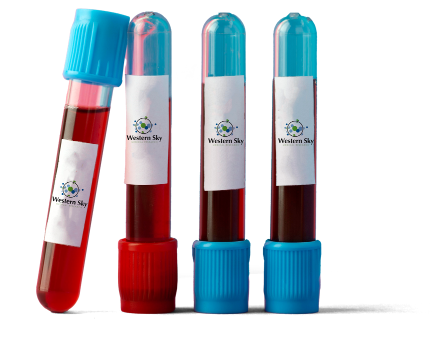 Four blood sample tubes with red liquid and colored caps, standing upright on a white background