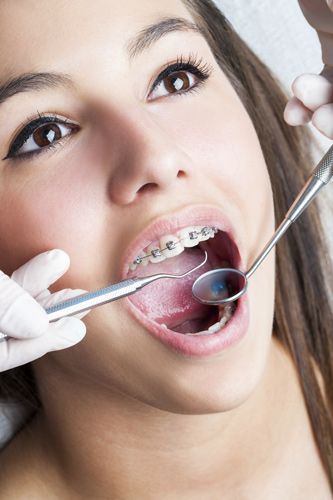 La caries: la consecuencia de una mala higiene bucal