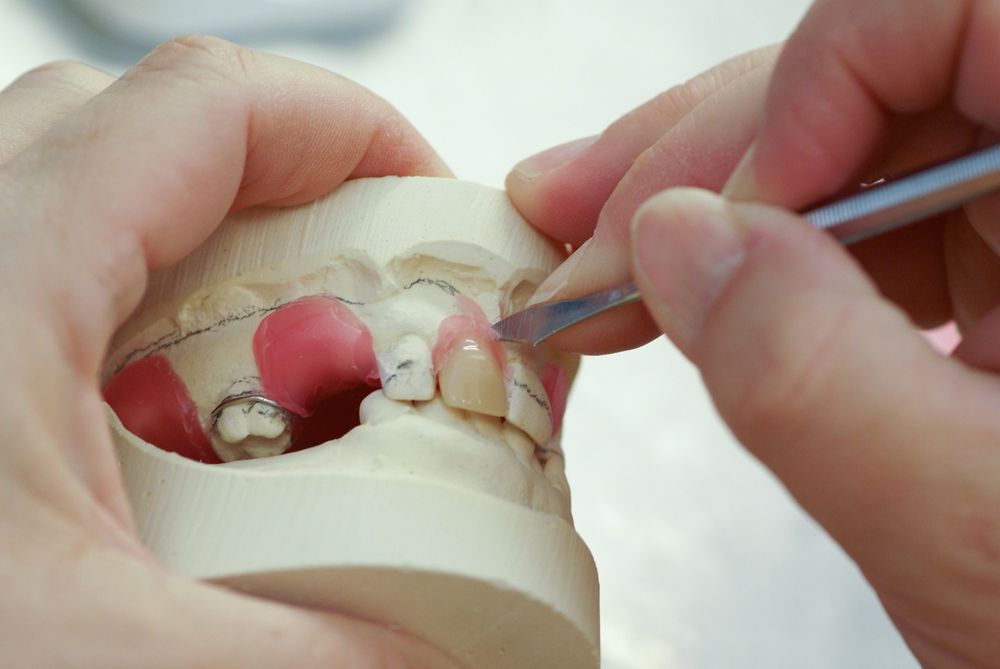 A Person is Working on a Model of a Person 's Teeth — Complete Denture Clinic in Kanwal, NSW
