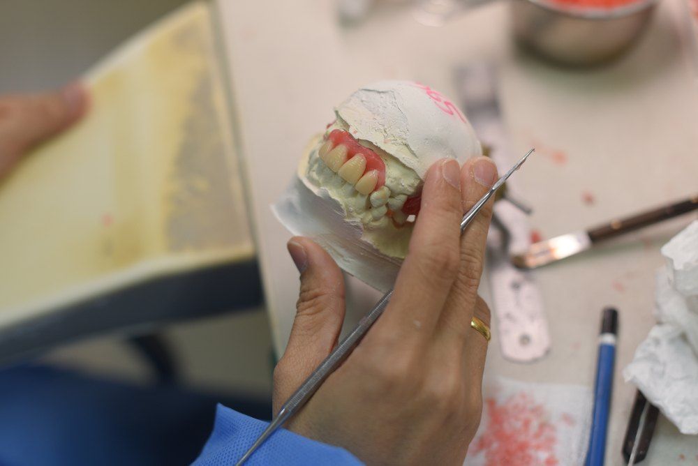 A Dentist is Working on a Model of a Person 's Teeth — Complete Denture Clinic in Kanwal, NSW
