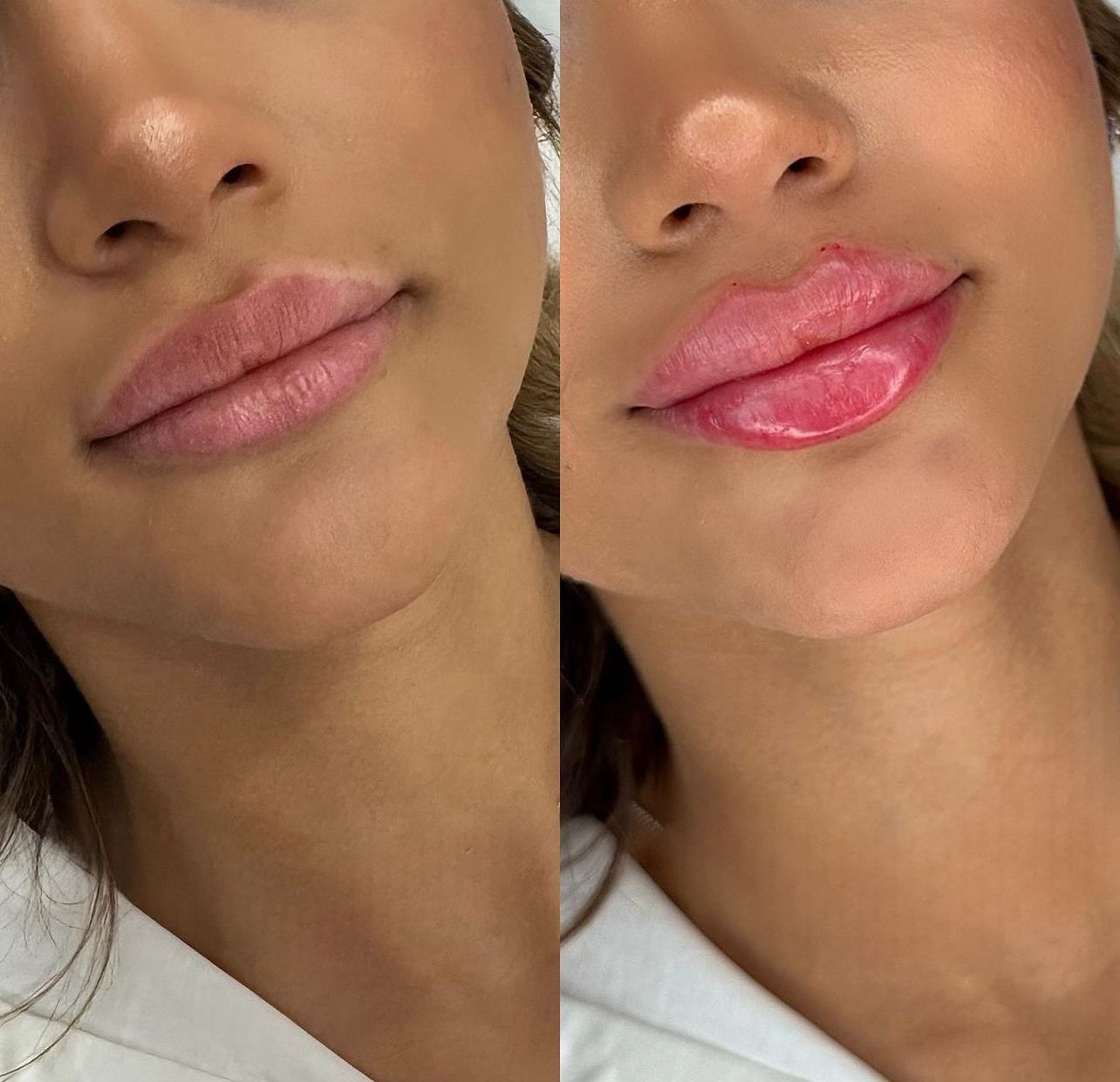 A before and after photo of a woman 's lips with pink lipstick
