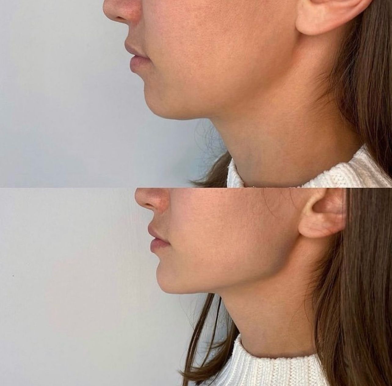 A before and after photo of a woman 's face.