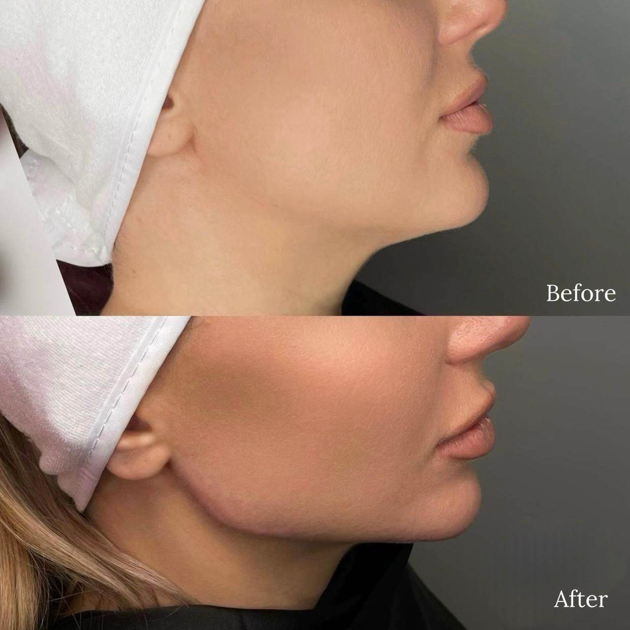 A before and after photo of a woman 's face