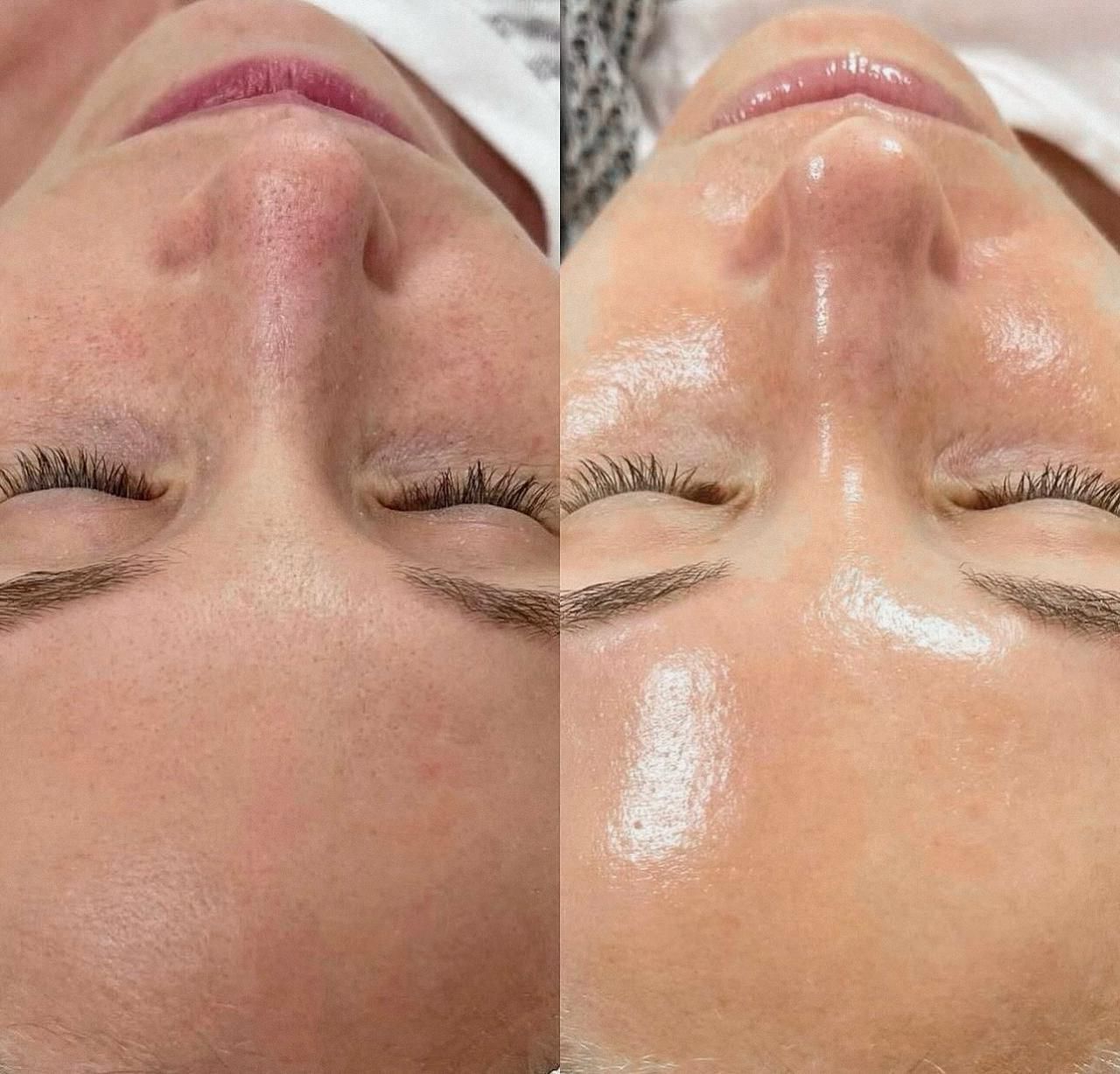 A before and after picture of a woman 's face with her eyes closed.