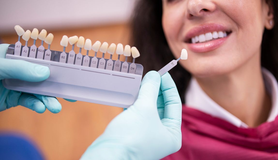A woman is trying on Veneers with the dentist.