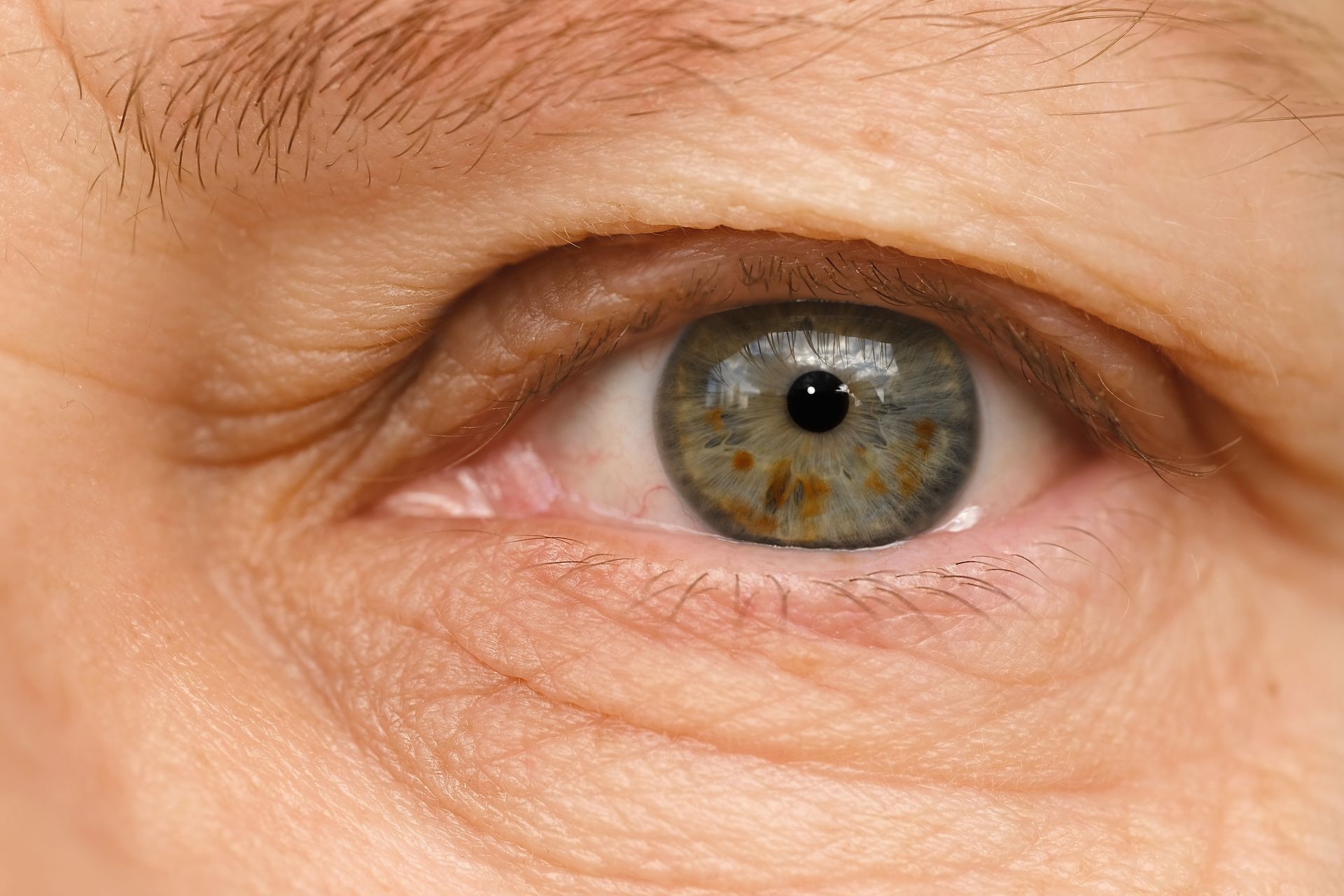 Close-up of a hazel eye with wrinkles around it Close-up of a hazel eye with wrinkles around it