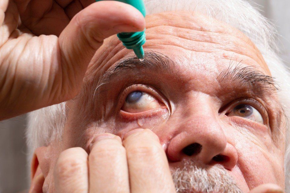 Occhio con cataratta