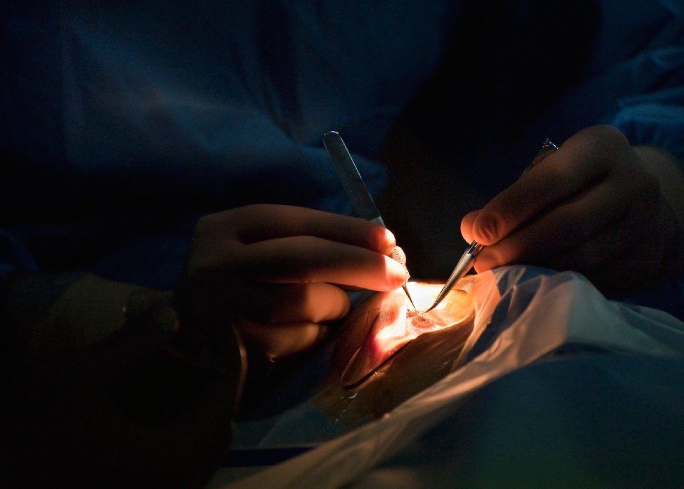 Laser a eccimeri