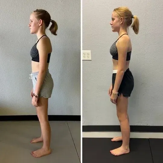 Side-by-side profile photos of a woman standing in workout clothes, showing posture comparison.
