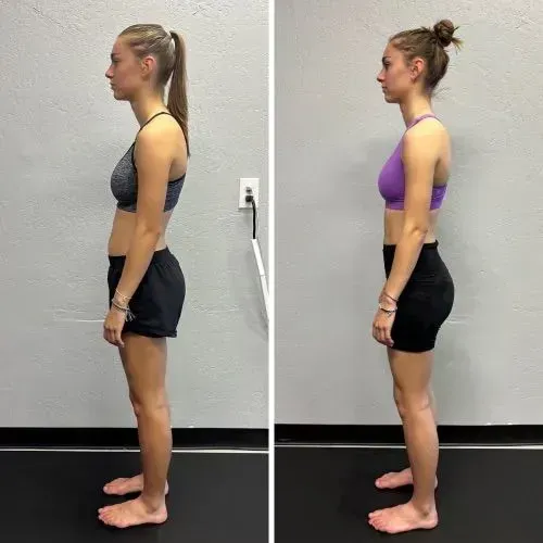 Side-by-side profile photos of a woman in gym clothes before and after posture changes