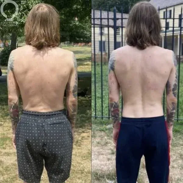 Side-by-side back view comparison of a person in shorts outdoors, showing before and after body changes.