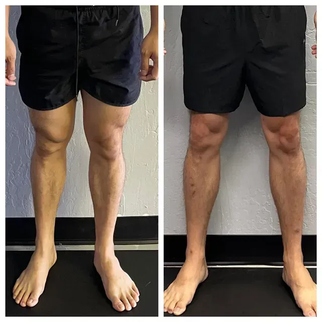 Front and back view of a person’s lower body wearing black shorts, standing barefoot indoors.