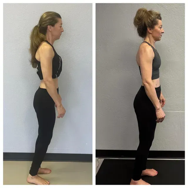 Side-by-side profile photos of a person standing upright against a plain wall, in black workout clothes.