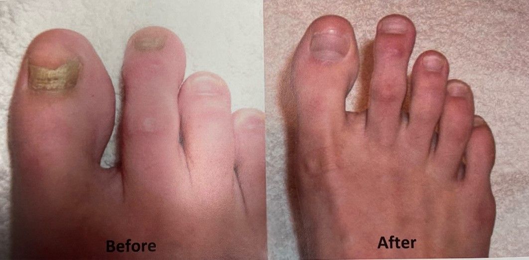 Why Choose North Tampa Foot Care - Tampa, FL - North Tampa Foot Care Why Choose North Tampa Foot Care - Tampa, FL - North Tampa Foot Care