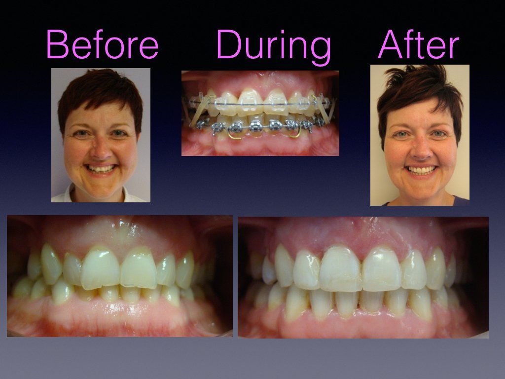 Before & after 3