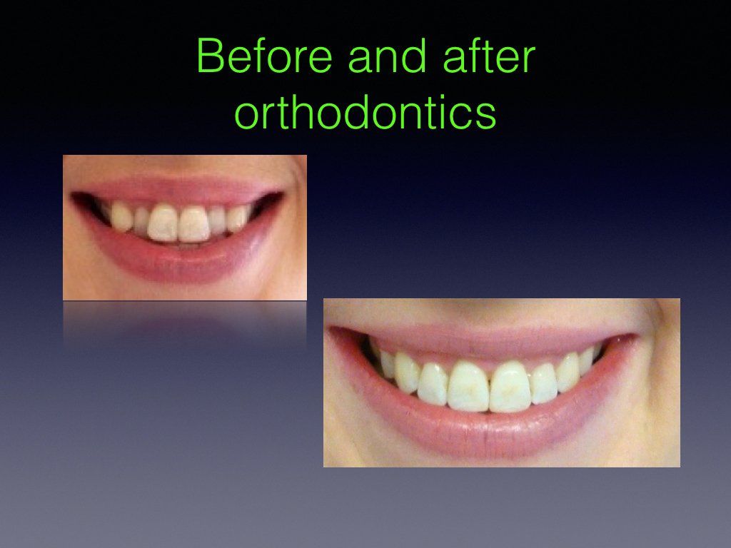 Before & after 4