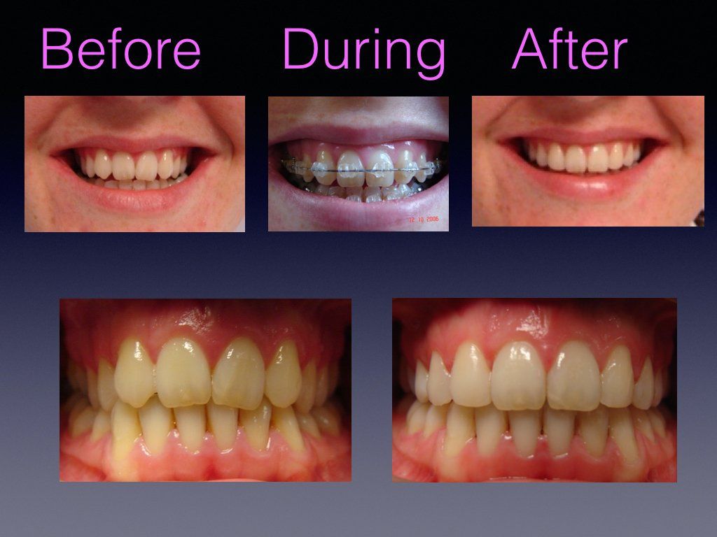 Before & after 2
