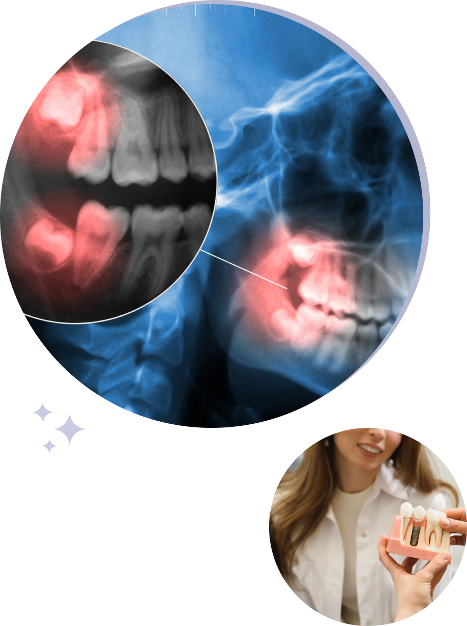 oral cancer screening