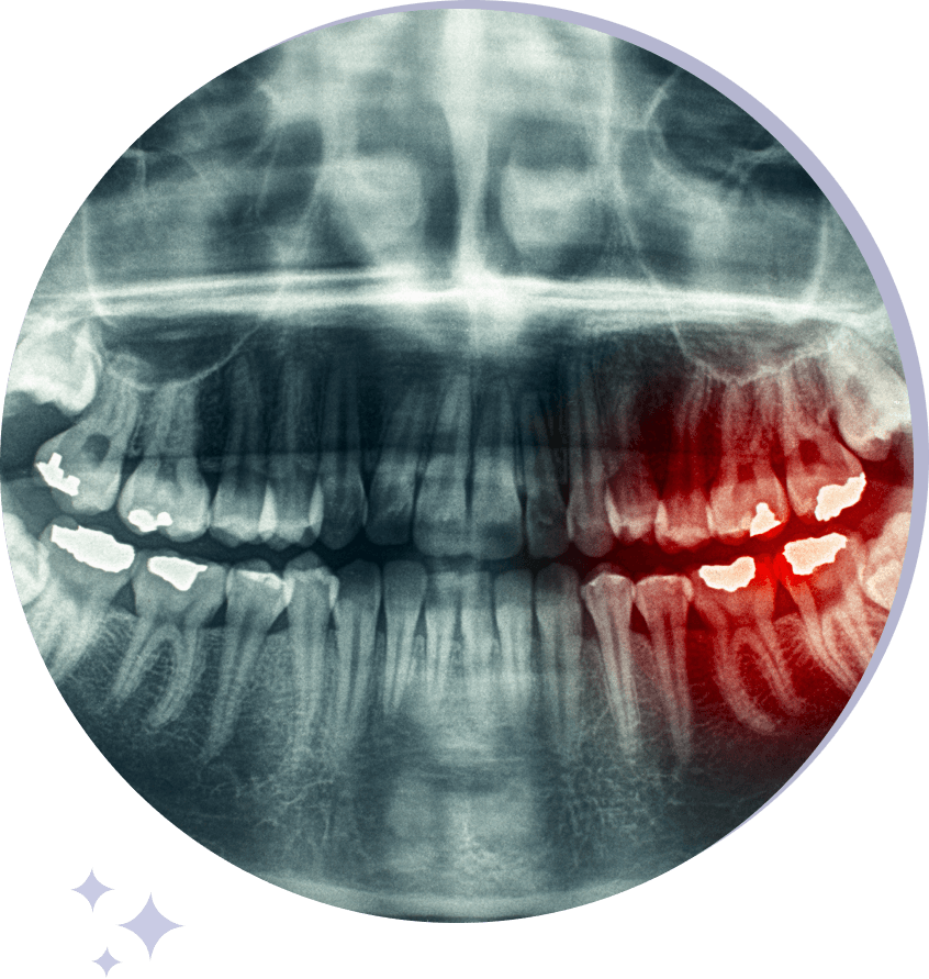treatment maxillofacial injury