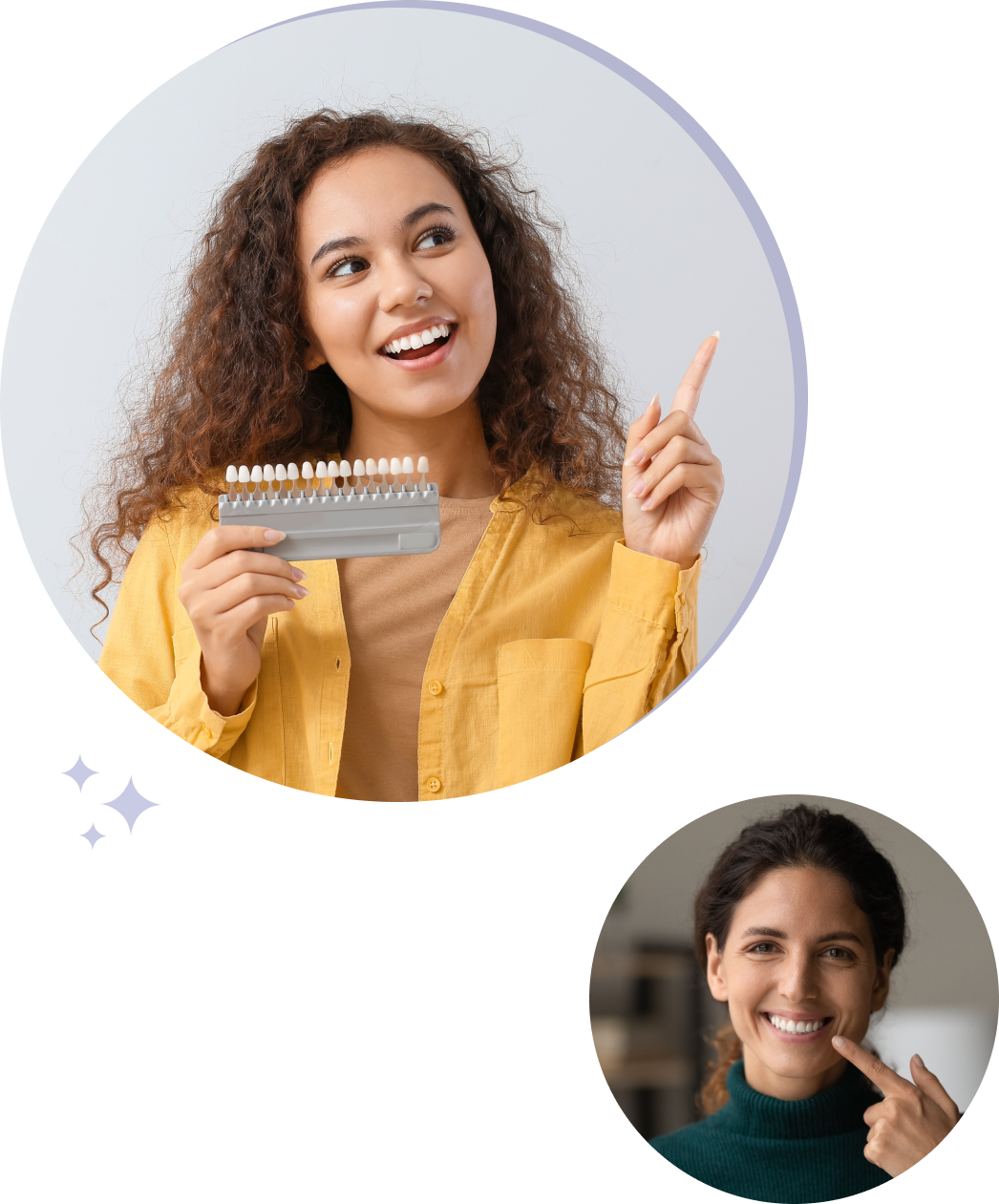dental veneer