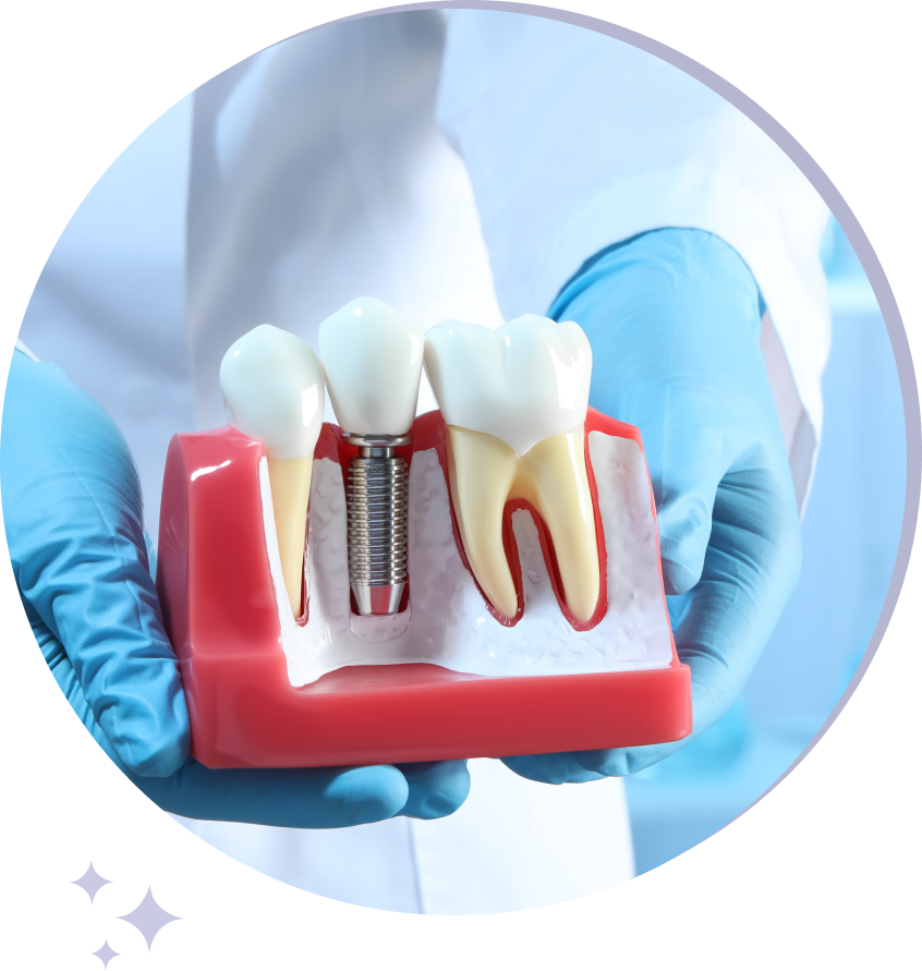 Implant-Supported Dentures