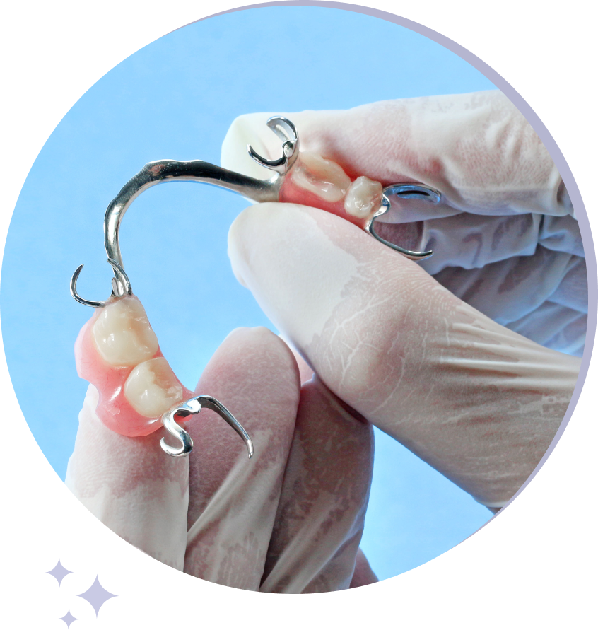 Partial dentures