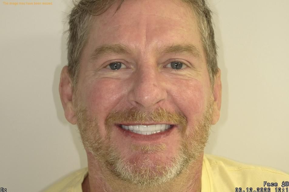 Close-up of a smiling man with a beard against a plain light background.