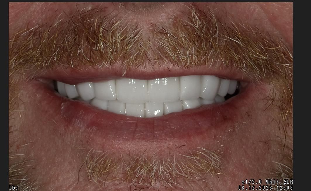 Close-up of a smiling mouth with white teeth and a mustache