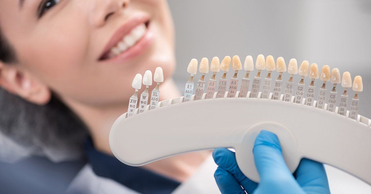 A person with a bright smile compares tooth shades with a professional shade guide in a dentist's office.