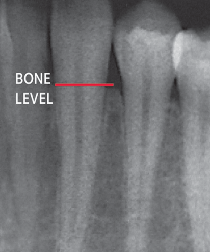 Dental X-ray — Hudsonville, MI — Hudsonville Family Dentistry Dental X-ray — Hudsonville, MI — Hudsonville Family Dentistry