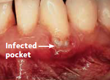Before Dental Treatment — Hudsonville, MI — Hudsonville Family Dentistry Before Dental Treatment — Hudsonville, MI — Hudsonville Family Dentistry
